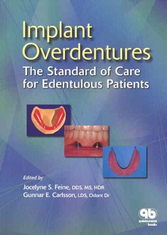 Download Implant Overdentures: The Standard of Care for Edentulous Patients