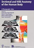 Sectional MRI Anatomy of the Human Body, Marinkovic, Slobodan, 3131177411