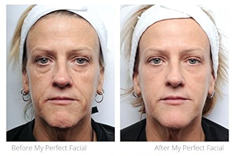 my perfect face products