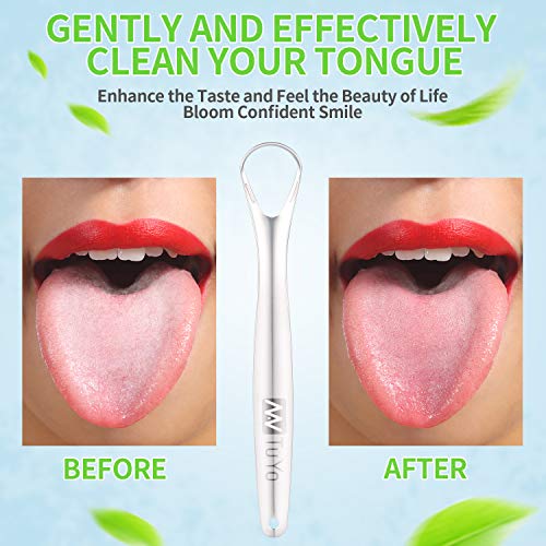 Tounge Scraper Cleaner, Surgical Stainless Steel Tongue Scrapers for Adults Kids, Bad Breath Treatment, Metal Dental Scraper for Fresh Breath, Reusable with Handy Carrying Store Case by NanTuYo