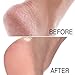 Dr. Foot Heavy Duty Foot Care Scrub & Moisturizer Creams For Calluses, Dead Skin, Tough Heels, Cracked Heels, & Rough Spots On Feet, Large 8 Fl Oz Bottle (8 Fl Oz (Pack of 1), Callus Foot Cream)