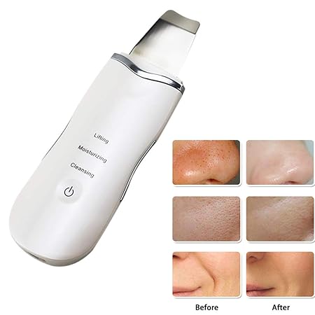 Ultraschall Gesichts Skin Scrubber Zum Entfernen Von Mitessern, Hautwäscher, Peeling, Faltenentfernung Mit Ultraschall-Vibrat