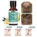Hair Growth Essence, Y.F.M Herbal Hair Growth Liquid Can Help Hair Growing Fast Longer - Strengthens Hair Roots - Hair Loss & Hair Thinning Treatment - Hair Treatment Product - 20ml