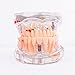 Tooth Model, Disease Teaching Study Adult Typodont Demonstration Teeth Model New
