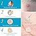Acne Patches, LANBENA Acne Treatment Pimple Patches for Removing Acne and Healing Acne Pimple Treatment for Absorbing the Secretions Skin Spot Treatment with Tea Tree Oil (acne patches 2)