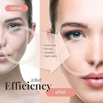 effective bleaching cream for black skin