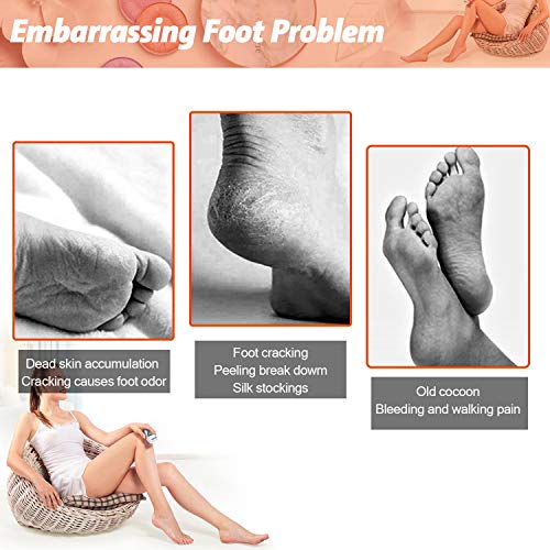 Electronic Foot File with Replacement Sandpaper Discs, Professional