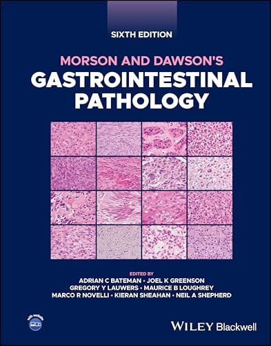 MacSween's Pathology of the Liver: 9780702066979: Medicine