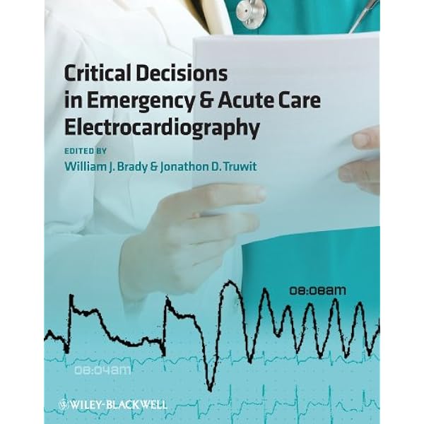 語学+参考書 Chou&#39;s Electrocardiography in Clinical Practice: Adult and Pediatric Chou's Electrocardiography in Clinical Practice: Adult and