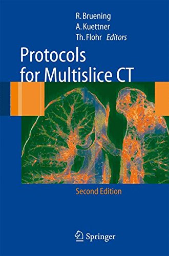 Protocols for Multislice CT