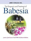 The Diagnosis and Treatment of Babesia