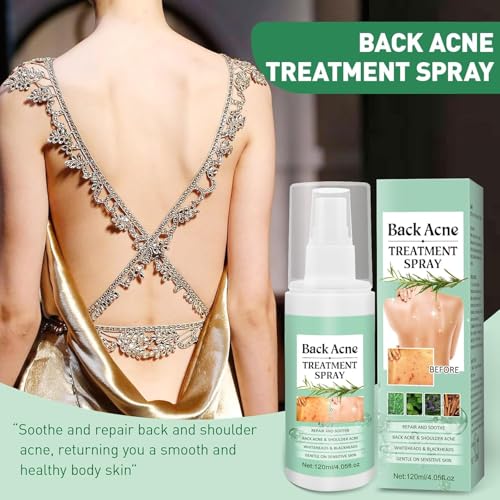LBOYLOVE® Back Acne Treatment Spray – 2% Salicylic Acid & Hypochlorous Acid Spray for Body Acne, 120ml – Deep Cleansing, Fades Scars, Soothing Repair for Back, Chest & Shoulders