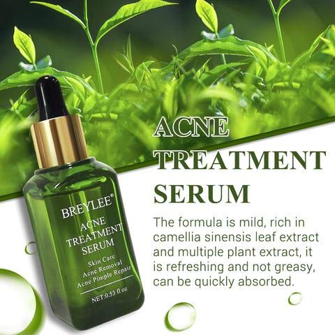 serum facial anti acne