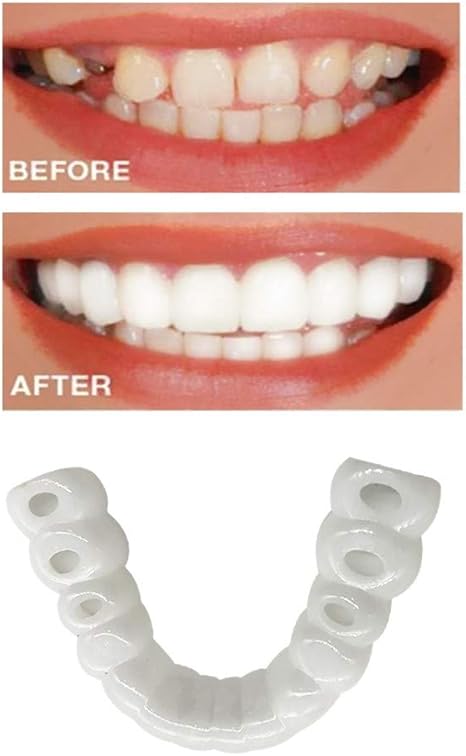 Serui Sbiancamento Dei Denti Perfetti Confortevole Denti Cosmetici Denti Da Denti Sorriso Denti Denti Fondo Impiallacciatura Cosmetica Amazon It Salute E Cura Della Persona