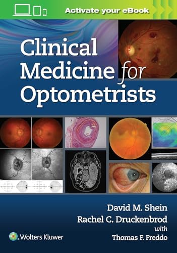 Clinical Management of Binocular Vision: 9781496399731: Medicine