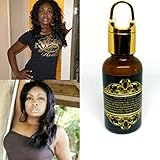 age spot lightening serum South Florida's Best Fast Skin Lightening Serum Arbutin+HQ 2% Whitening Serum - Lighter Skin in 14 days - Wrinkle Fillers Hylauronic acid,Brightening,Alpa Arbutin Powder,Kojic Acid Powder age spot remover for face