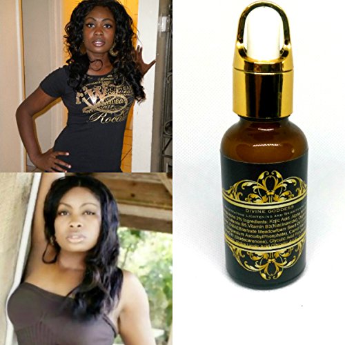age spot lightening serum South Florida's Best Fast Skin Lightening Serum Arbutin+HQ 2% Whitening Serum - Lighter Skin in 14 days - Wrinkle Fillers Hylauronic acid,Brightening,Alpa Arbutin Powder,Kojic Acid Powder age spot remover for face age spot lightening serum South Florida's Best Fast Skin Lightening Serum Arbutin+HQ 2% Whitening Serum - Lighter Skin in 14 days - Wrinkle Fillers Hylauronic acid,Brightening,Alpa Arbutin Powder,Kojic Acid Powder age spot remover for face