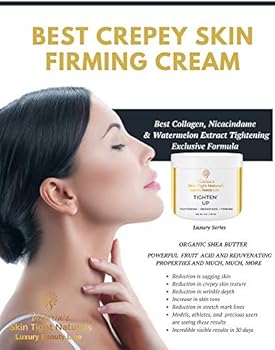 amazon crepey skin cream