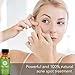 Tea Tree Essential Oil, 1 Fl Oz with Dropper - Undiluted Therapeutic Grade for Your Face, Skin, Hair and Diffuser - 100% Pure Melaleuca Oil for Acne, Toenails - by Pure Body Naturals