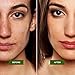 7X FASTER Acne Treatment for Scars, Cystic Spots & Blackheads Secret TEA TREE OIL + Salicylic Acid Dermatologist Recommended for Fast Scar Removal - Get Rid of Bacne in Days (1 oz)