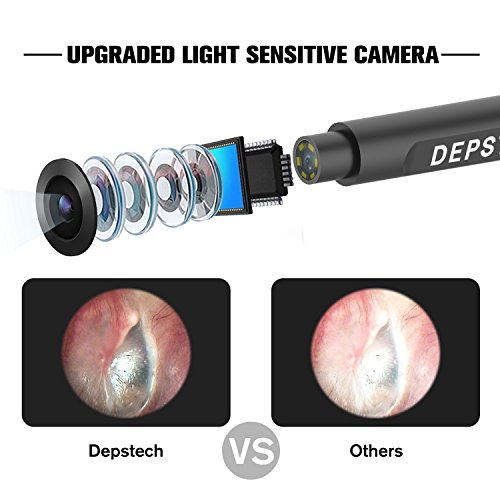 1 Wireless+Otoscope+DEPSTECH+Inspection+Cleansing