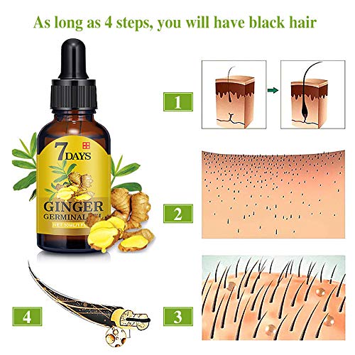 Hair Growth Oil Serum Liquid Hair Loss Treatment for Men Women Thicken Healthier Stronger Longer Hair，Stimulate Hair Follicles to Stop Hair Loss and Regrow Hair, All Hair Type