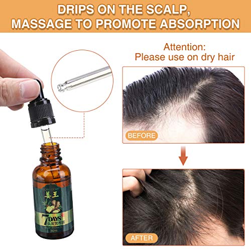LIUMY Ginger Germinal Oil, Hair Growth Serum-Ginger Essential Oil, Hair Loss Treatment for Women and Men Dense Thicken Hair (30ml)
