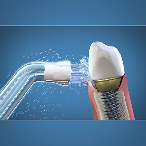 Replacement Part for Waterpik or other Water Flossers/Irrigators (AquaFlosser 4 tips) - Thumbnail 4
