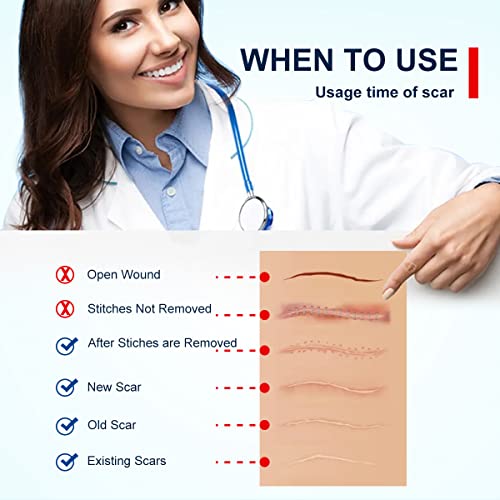 ZODENIS Scar Away Silicone Scar Sheets, Scar Tape(1.8” x 157”Inch- 4M), Scar Strips, Reusable, Professional Scar Remover for C-Section, Surgery, Keloid, Tummy Tuck, Scar Patch, Scar Pads.