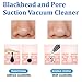 Skymore Blackhead Remover Vacuum Pore Cleaner