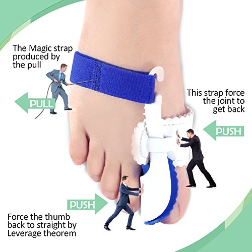Bunion Corrector & Bunion Relief Kits,Adjustable Bunion Splint and Soft Bunion Pads for Treat Pain in Hallux Valgus, Big Toe Joint, Hammer Toe,Toe Spacers Straighteners for Men and Women