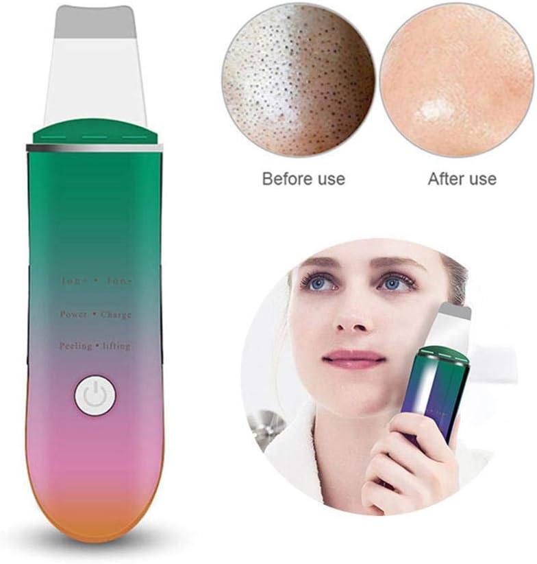 Multifunctional Facial Skin Scrubber, Ultrasonic Blackhead Dead Skin Remover, USB Charging Cordless Ion Skin Scrubber Spatula for Deep Clean Facial Lifting