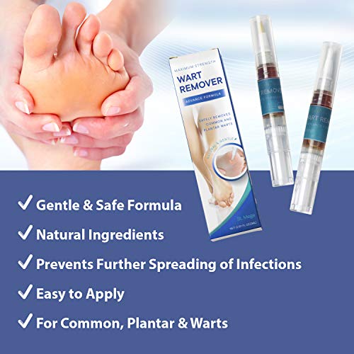 ST. Mege Wart Pen - Maximum Strength - Wart Pen for Flat Warts, Plantar Warts, Common Warts - Corn, Callus - Lightweight - Easy-to-Use - Travel-Friendly