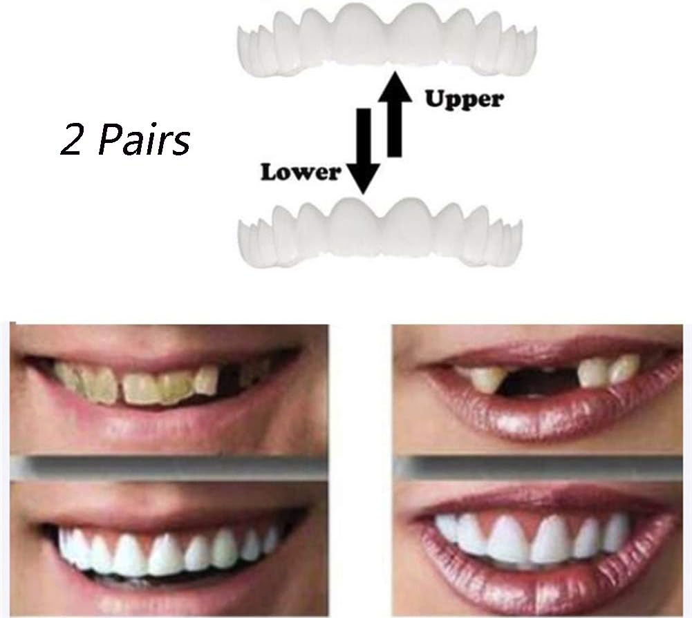 2 Pairs Silicone Veneers Teeth Temporary Cosmetic Teeth Denture Simulated Braces Upper Braces And Lower Braces Comfortable Dental Care Accessories