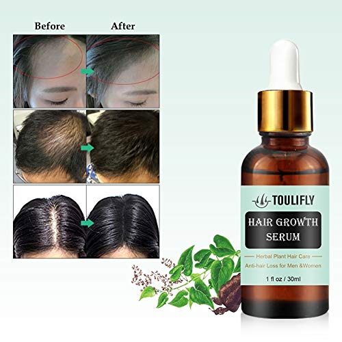 TOULIFLY Hair Growth Serum Hair Growth Treatment Oil Hair Regrowth Serum Anti-hair Loss Hair Treatment for Thinning Balding Hair Promotes Hair Growth for Men Women