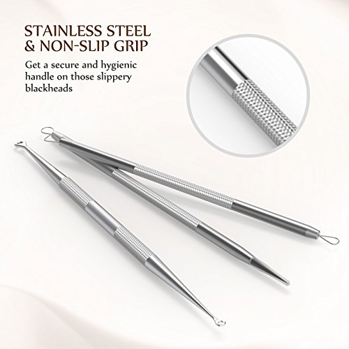3 Anjou+Blackhead+Professional+Stainless+Extractor