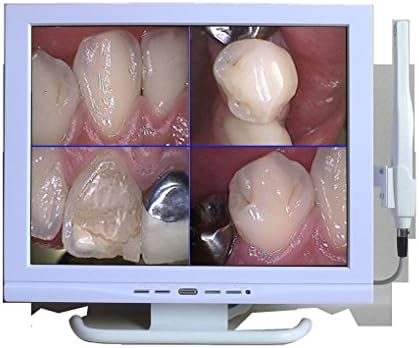 Brand New ORC-01A Multi-Media Dental Camera with Sony HAD CCD Image Sensor and Color 15 inch 4:3 Monitor
