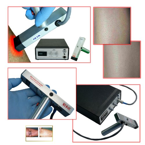 SDL30EC-DX at Home and Professional Epidermal Contact Diode Laser System Permanent Hair Removal and More