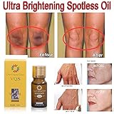 GARYOB Dark Spot Remover Age Spots Oil Ultra Brightening Spotless Oil Hyper-Pigmentation (2PCS)