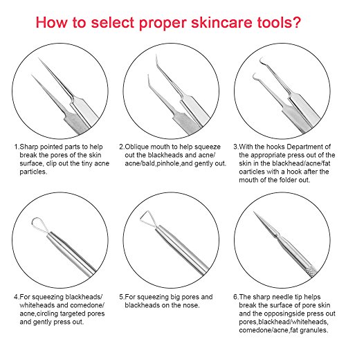 Blackhead Whitehead Splinter Remover Cure Pimples Comedones Zit