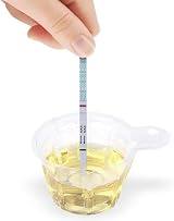 ANZONGYI 200Pcs 40ML Clear Urine Container Disposable Specimen Cups Pregnancy view 6