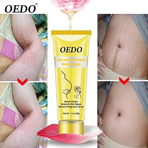 rose remove stretch marks cream