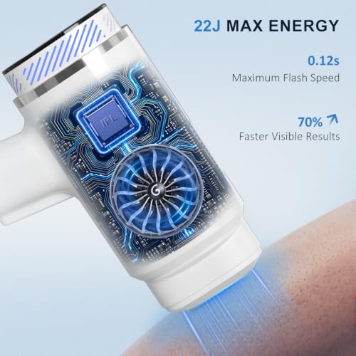 NALONE 22J Pulsed Light Epilator Touch Screen, 4-IN-1 Definitive Laser Hair Removal -HR/SC/RA/BT, 10 Levels Home Women & Men, Face, Body, Armpits