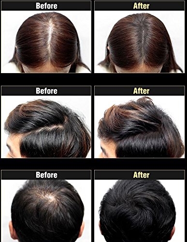 DASHU Anti-Hair Loss Hair Cushion Hair Concealer Hair Building Fibers Black / Dark Brown / Light Brown (26g, Light Brown)
