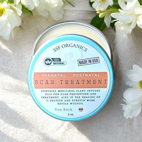 SSF Organics Scar Treatment for Stretch Marks, C-Section Recovery Must Have- Deeply Moisturize with Calendula, Castor, Shea - Advanced Scar Treatment for Mama Related Wounds