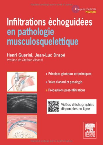 Infiltrations échoguidées en pathologie musculosquelettique