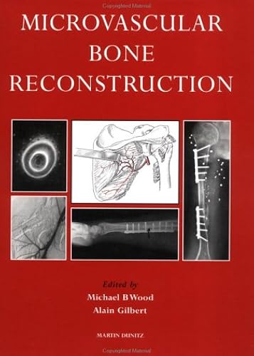 Download Microvascular Bone Reconstruction PDF