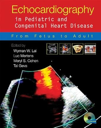 Amazon Com Echocardiography In Pediatric And Congenital