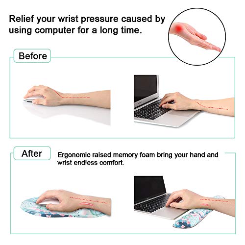 Anyshock Keyboard Wrist Rest and Ergonomic Mouse Pad with Wrist Support