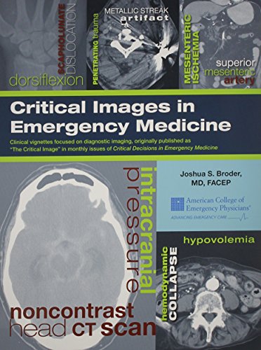 Critical Images in Emergency Medicine